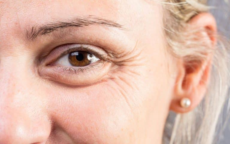 ממה נובעים קמטים