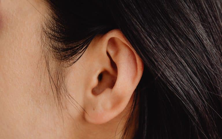 תיקון תנוך האוזן