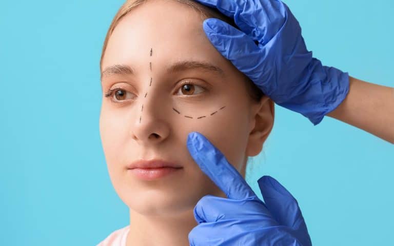 הרמת עפעפיים