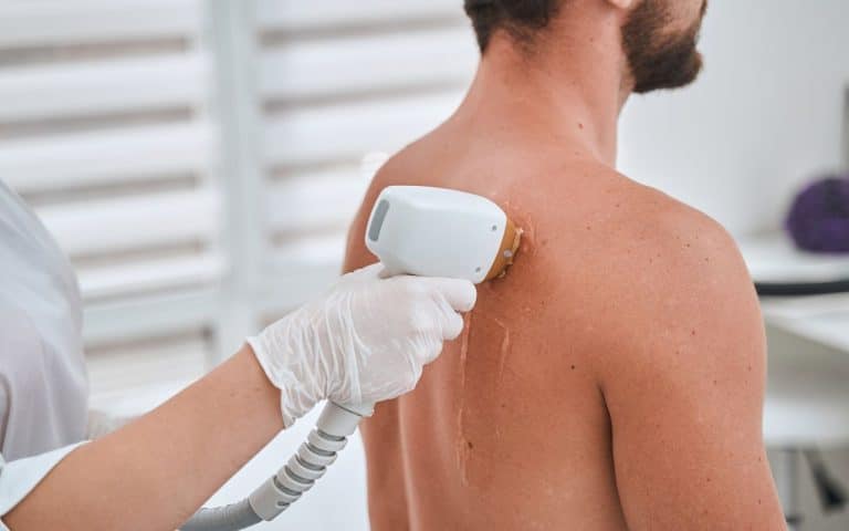 הסרת שיער בגב