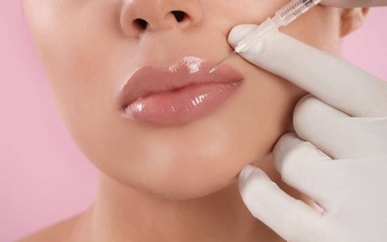חומצה היאלורונית לשפתיים