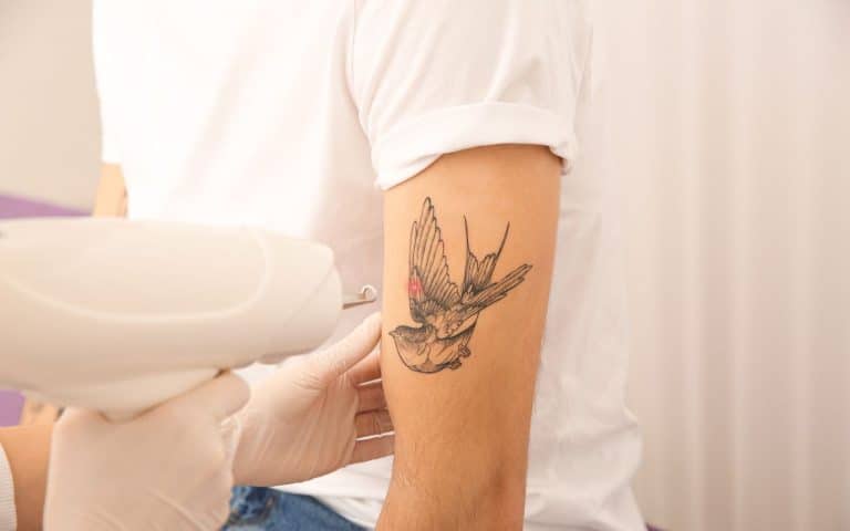 על קעקועים והסרת שיער בלייזר