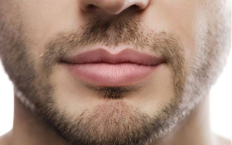 מילוי שפתיים לגברים