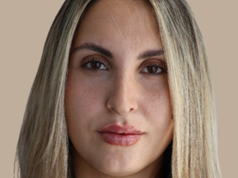 עיבוי שפתיים אחרי