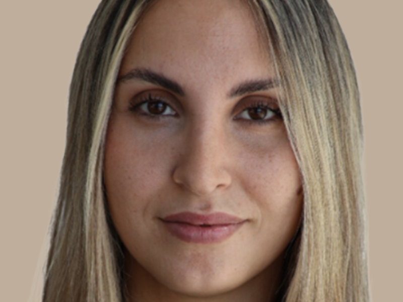 עיבוי שפתיים לפני