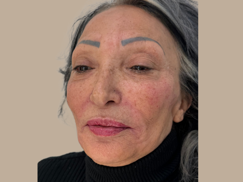 אחרי חומצה, שפתיים ולולה