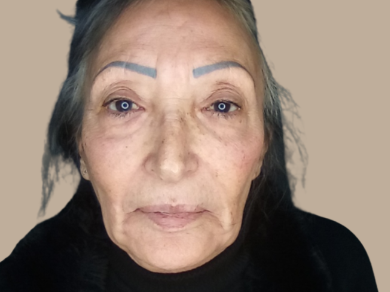 לפני חומצה, שפתיים ולולה