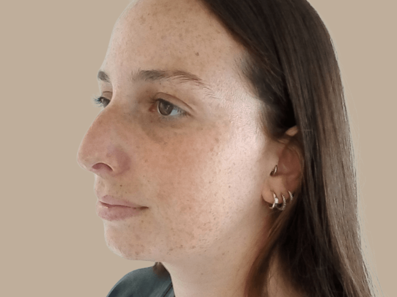 נועה לפני (2)