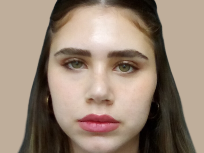 ניתוח אף אחרי