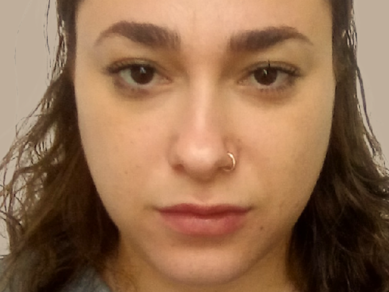 עדן לפני עיבוי שפתיים