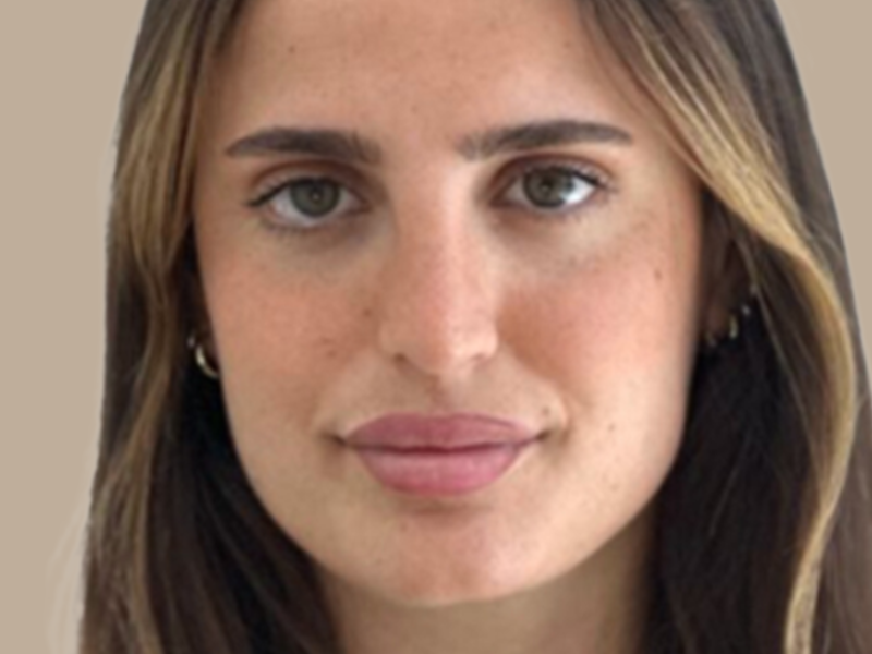 עיבוי שפתיים אחרי