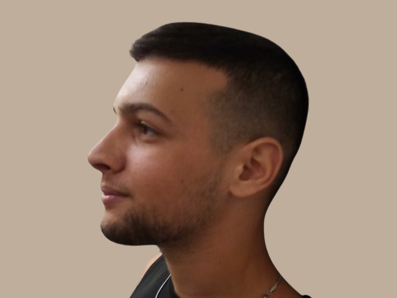 ניתוח אף לפני