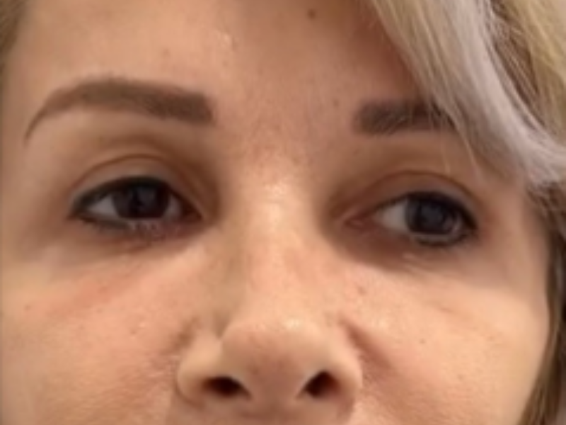 לפני חוטים בעיניים