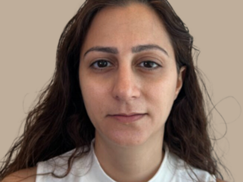 יובל לפני שקעי עיניים