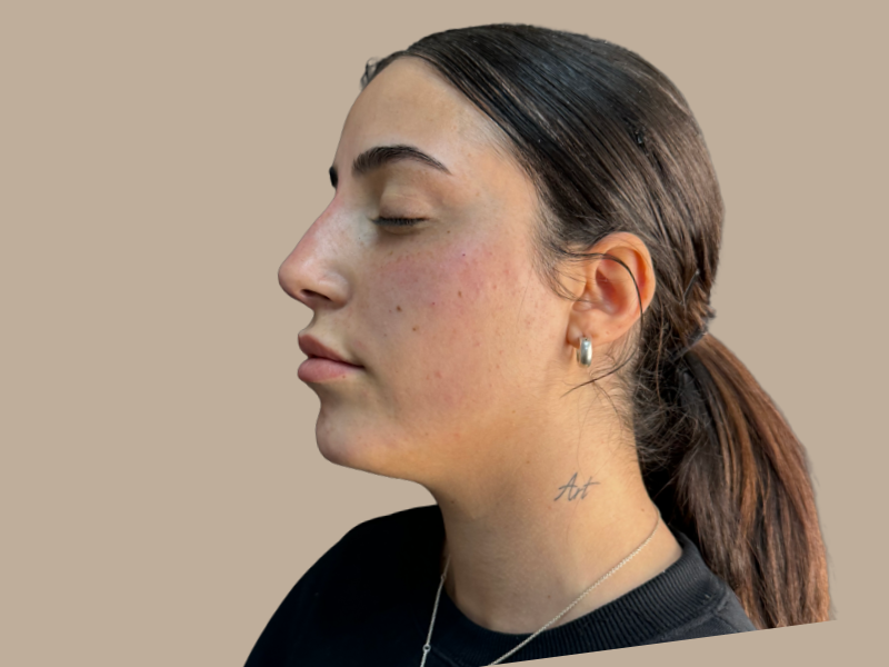 פיסול סנטר אחרי