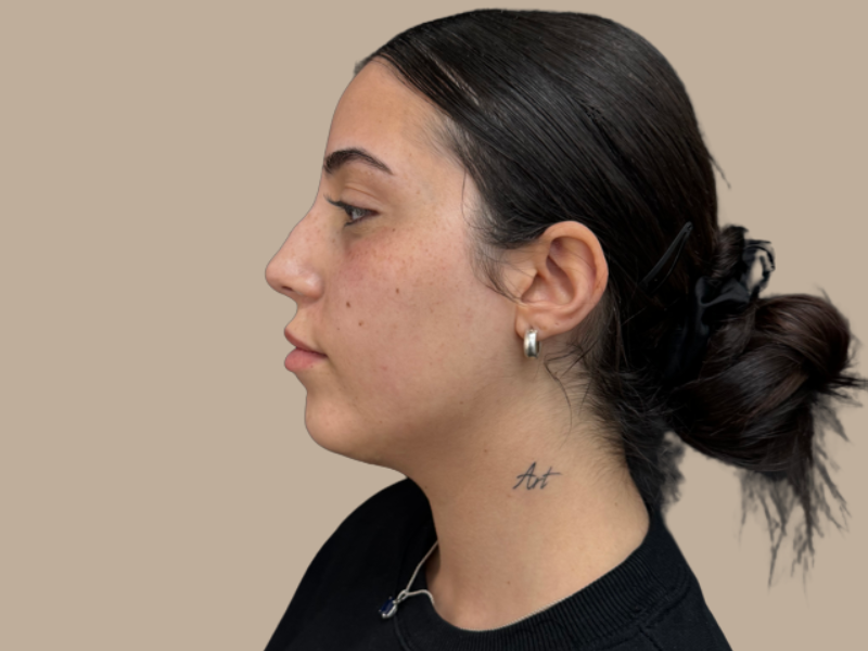 פיסול סנטר לפני