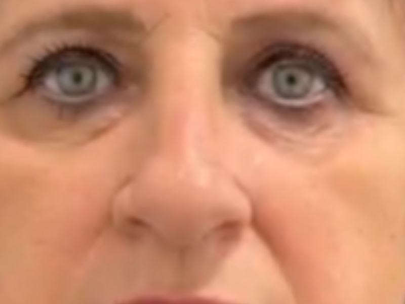 אחריי חוטים בעיניים