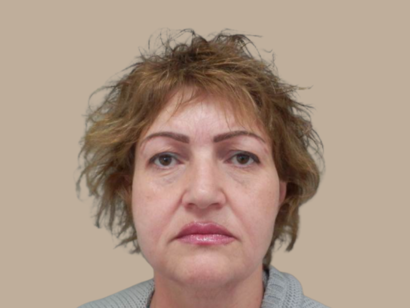 לפני מתיחת פנים