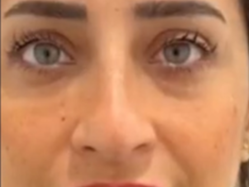 לפניי חוטים בעיניים