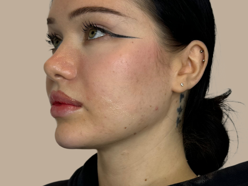 פיסול סנטר אחרי