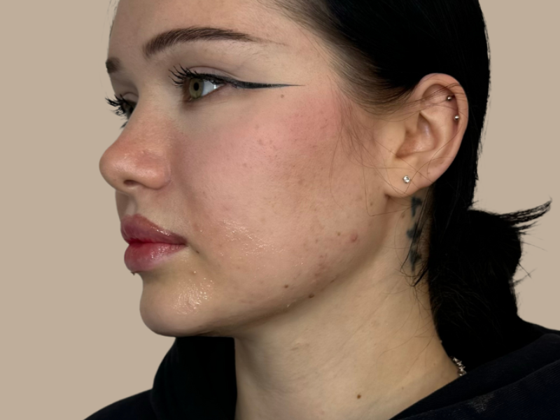 פיסול סנטר לפני