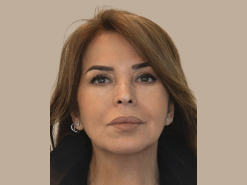 שושי אחרי חומצה היאלרונית