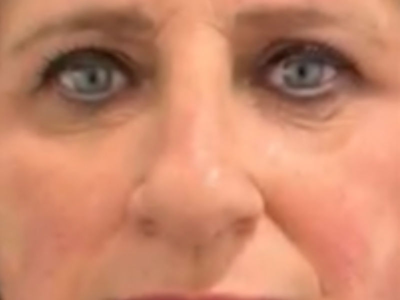 אחרי חוטים בעיניים