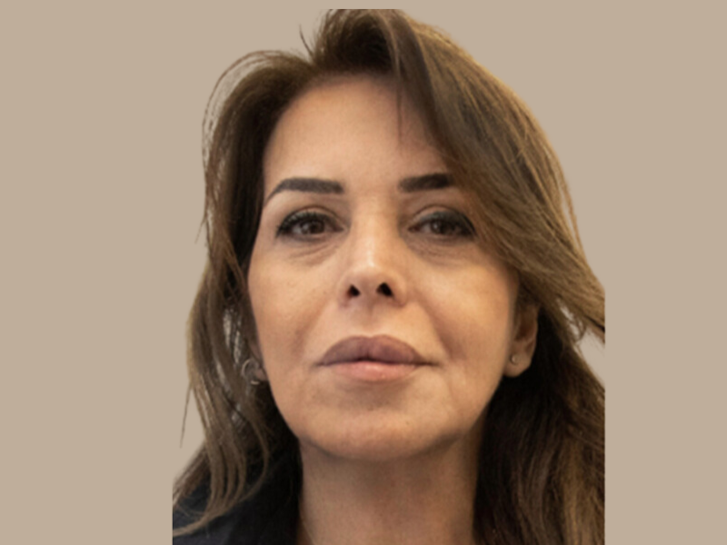 שושי לפני חומצה היאלרונית