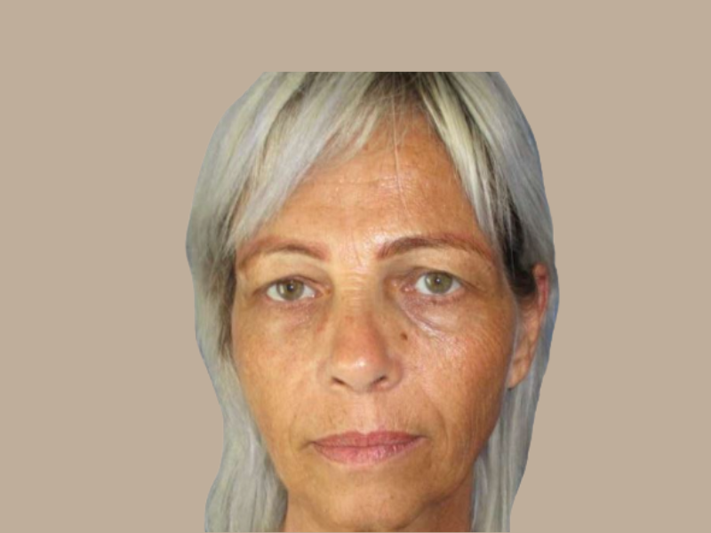 לפני מתיחת פנים